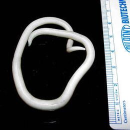 Kifejlett nőstény orsóféreg (Ascaris lumbricoides)